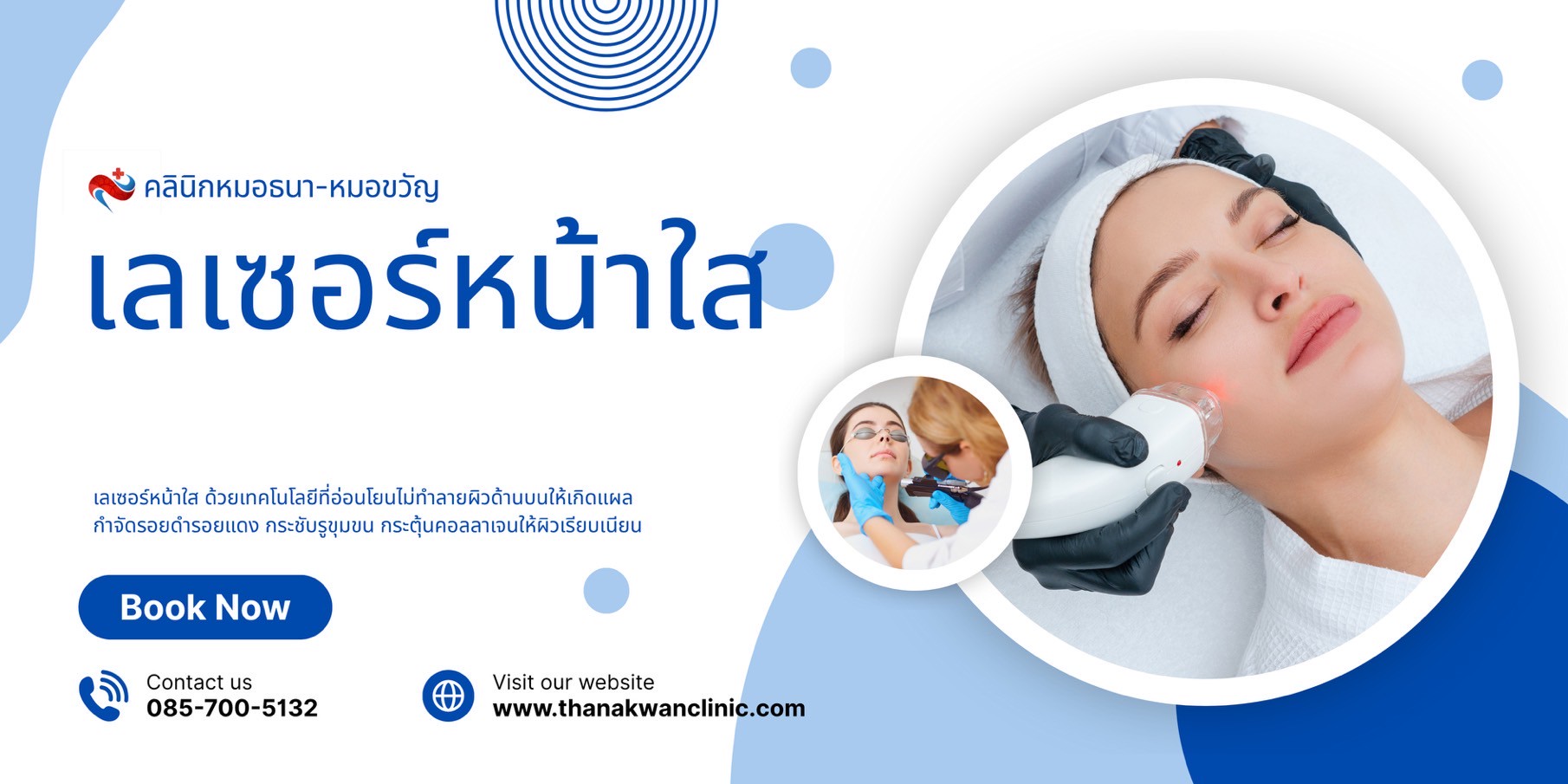 เลเซอร์หน้าใส รักษาผิวหน้าให้เรียบเนียน